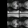 fimeiiiii