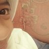 __abila