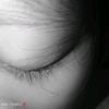 amelhyper01