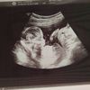 lsr.baby3