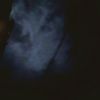bul_hir79
