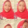 anira.ambesia