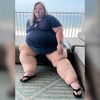 MyPCOSLipedemaLife