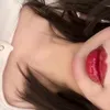 gn__f4