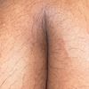 celak.purett