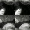 xynkhaa8