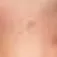 remondesu1