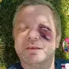 hniti_mozku.pro_vas