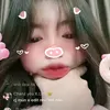 chanzmisslinn