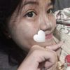 bdkk_kedokan2