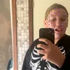 saskiacolla