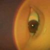 foresteyes6