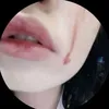 7_mll4