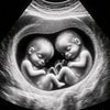 tomber enceinte rapidement