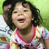 keriting
