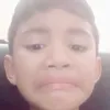 hudkgcs