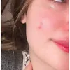 slhuvj