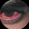 t_xo38