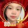 l.nh.trn50