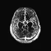 Psychology Brain