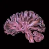 mindterms