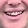 hemoglobincharliekirk