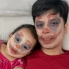 lipealieph