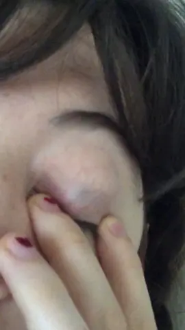 WTFF WHY MY EYE LIDS SEE THRU #fyp