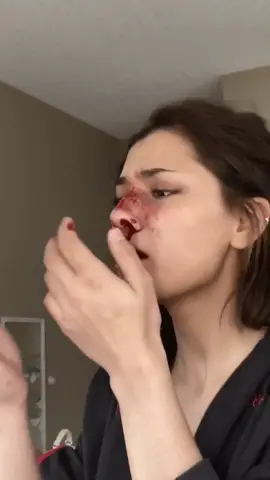 #pov you broke her nose but she realized she can’t hit you back because she’s 18 and you’re 16 #fyp #foryou