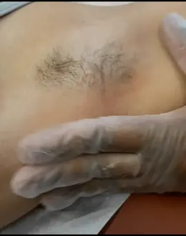 #waxing #waxvideos #waxingvideo #hairremoval #featureme #foryourpage #fyp #underarmwax