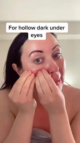 Follow @skinbysarahford on Instagram #darkeyes #holloweyes #darkcircles #aesthetic #esthetician #lymphdrainage #massage #skin #beauty #skincare