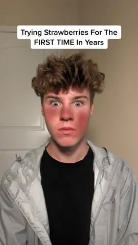 I didn’t think I was still allergic 🔥😣 #comedy #prank #vfx