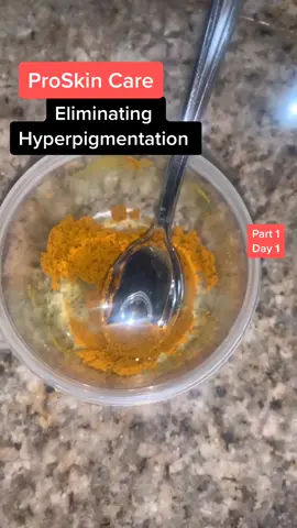 Eliminating Hyperpigmentation Day 1 #keepingactive  #MySkinandME #skincareroutine #skincaretips #hyperpigmentation #darkcircles #beautyroutine #acnh