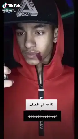 تفاحه بي منتفص الجبه والخكري معه
