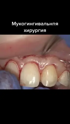 #dentistlife #tiktok #stomachchallenge #stomatolog #tophits #stoma #moscow #moscowcity #stomatologia #тор #dentistry #medic #dentiste #topfunnyasif