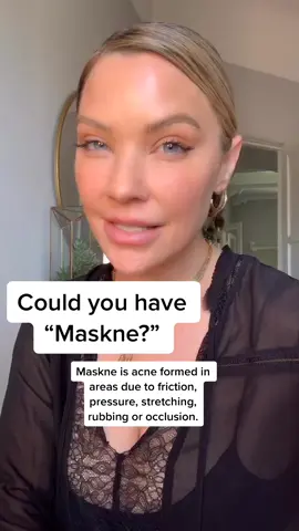 And that’s on having full blown ACNE again at 35 years old 😷🤦🏼‍♀️ #acne #acnehacks #maskne #acnehelp
