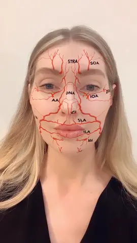 Found a new filter - facial arteries 🩸 #medical #nurse #fyp #dermalfiller #antiwrinkle #lipfiller #lipfillercheck #cosmetics #nurselife