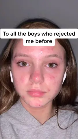 your loss