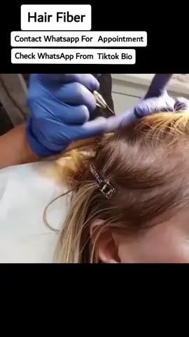 Hair fiber for bald areas #foryou #foryoupage #zarpashbeautyclinic #sportlover #viralvideo #trend #duetwithme #duet #viral #xxx #standwithkashmir