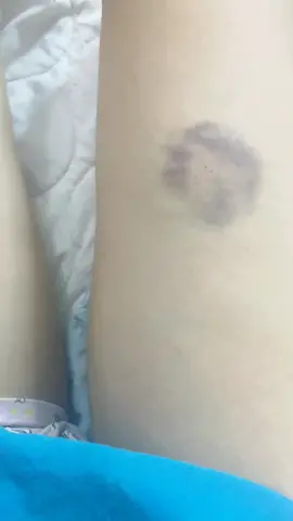 🤭🤭😞 auch 😓 #TikTok #goviral #challenge #golpechallenge #foryoupage