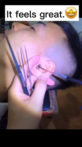 Do u want to try it.Look at my homepage #ear #removal #earwax #earexpert #fyp #earwaxremoval