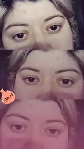 facial expression thru your eyes#dennyshurtado