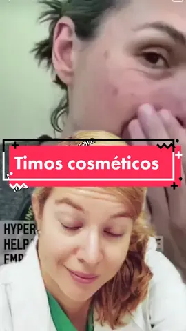 Huye mientras puedas...#acne #manchas #timo #greenscreenvideo #influencer #todoporlapasta