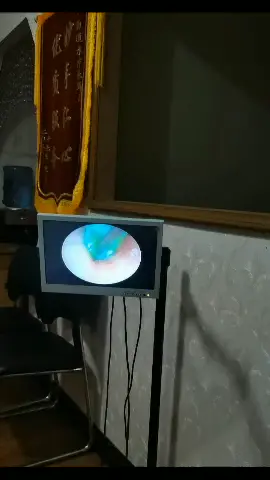 #fyp