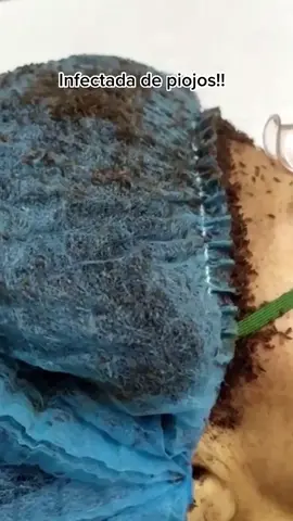 Me sorprendió mucho el vídeo, como se puede llegar a ese extremo? #parati#piojos#viral#fyp#wow