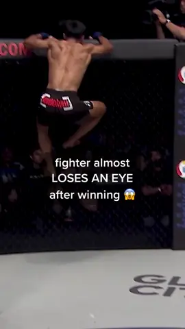 Not clickbait 😳 @sunotomma #ONEChampionship #MMA #MuayThai #Kickboxing #MartialArts #Boxing #TraumaticCheck #StoryTime #scarystories #scary