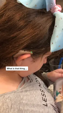It’s ok to ask!🤟🏼 #deafculture #cochlearimplants #deafcommunity