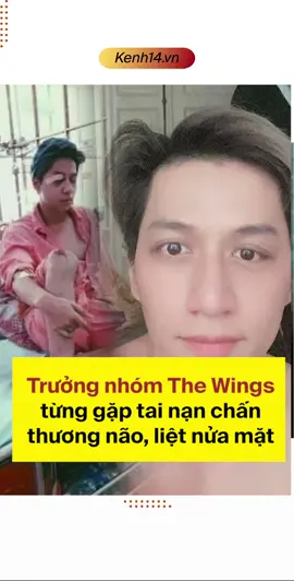 Trưởng nhóm The Wings từng gặp tai nạn chấn thương não đến liệt nửa mặt: 