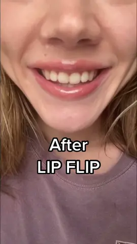 💉lip flip #lipflip