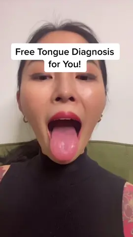 Show me your tongue! 🤩👅 ( this is NOT a medical diagnosis! The goal is fun + education :) #LearnOnTikTok #tiktokpartner #tongue #chinesemedicine